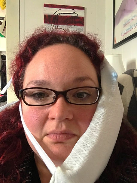 all the redness & all the ice packs means SEXXXAAAYY